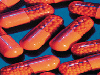 article_13_Infectiidetracturinarsuperior-Pielonefritele.gif