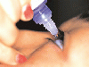article_7_Glaucomul-Afectareaocularaprogresivapoatefiprevenita.gif